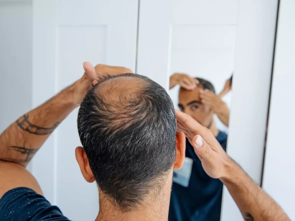 10 Effective Tips to Prevent Hair Loss