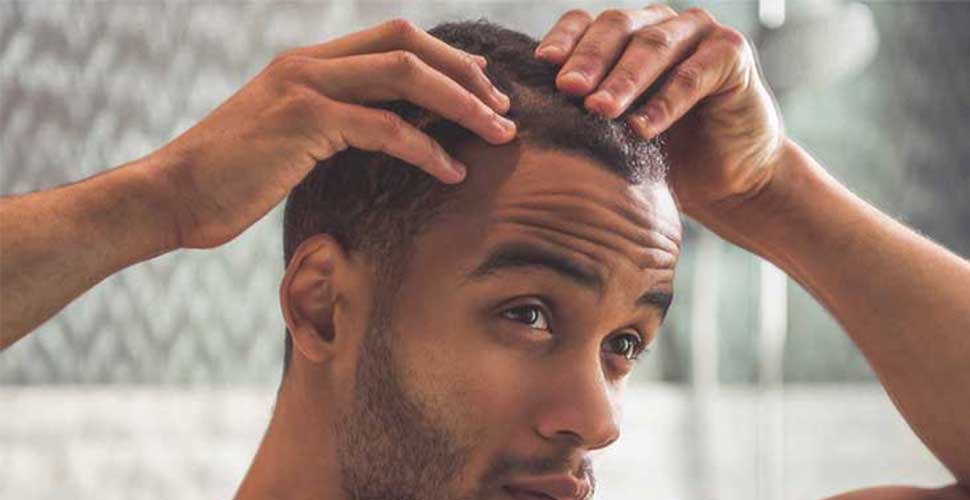 Common Misconceptions about Hair Loss Debunked